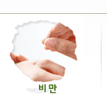 비만 