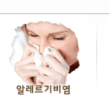 알레르기비염
